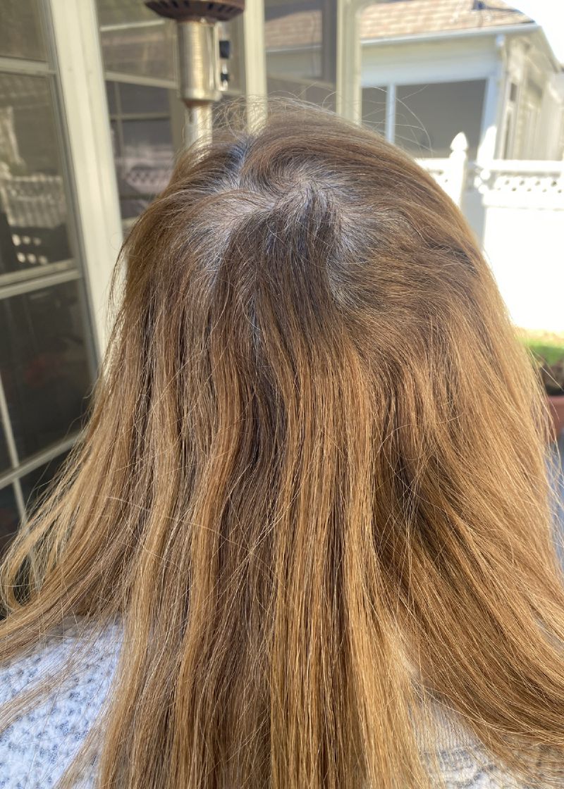 Before transformation
